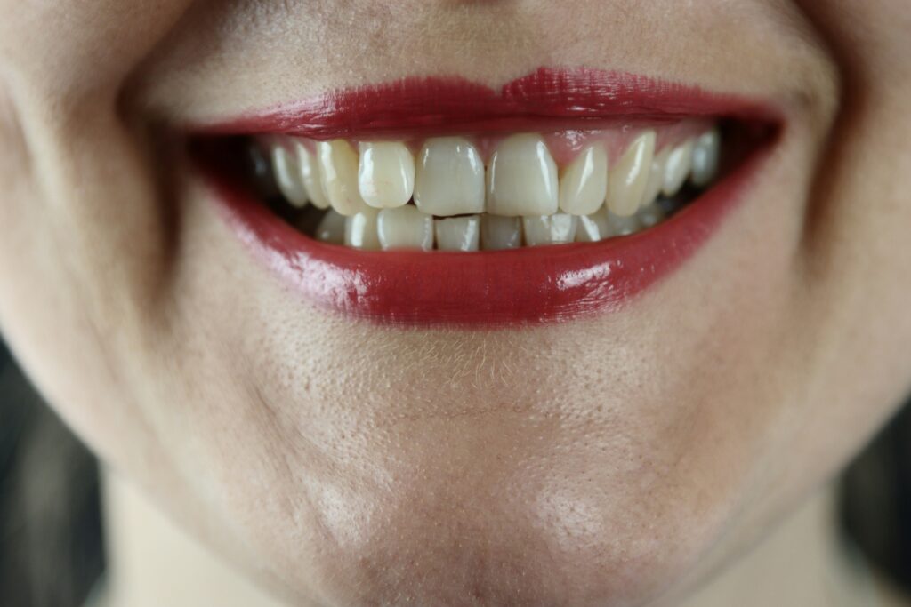 sensitive teeth