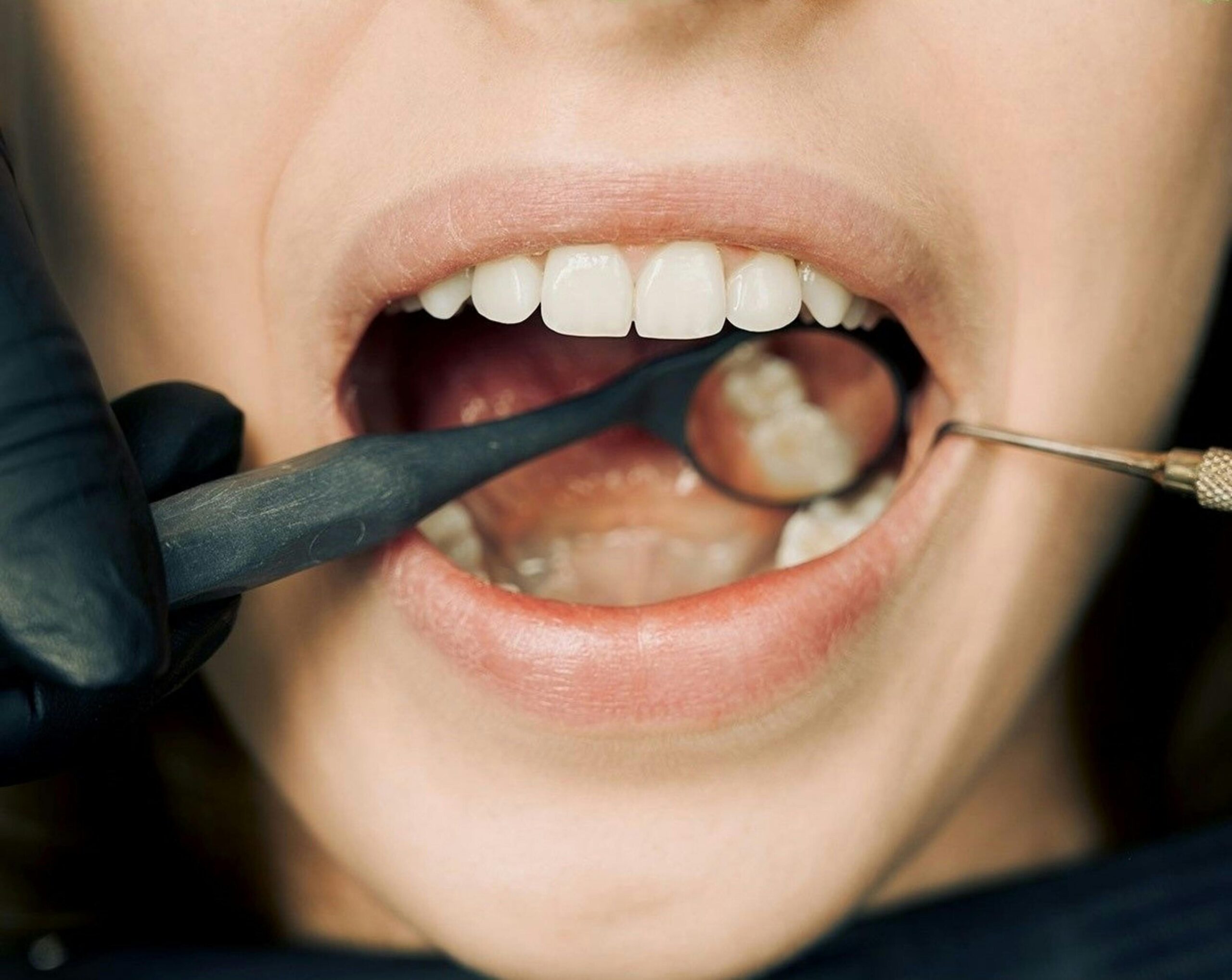 dental treatment