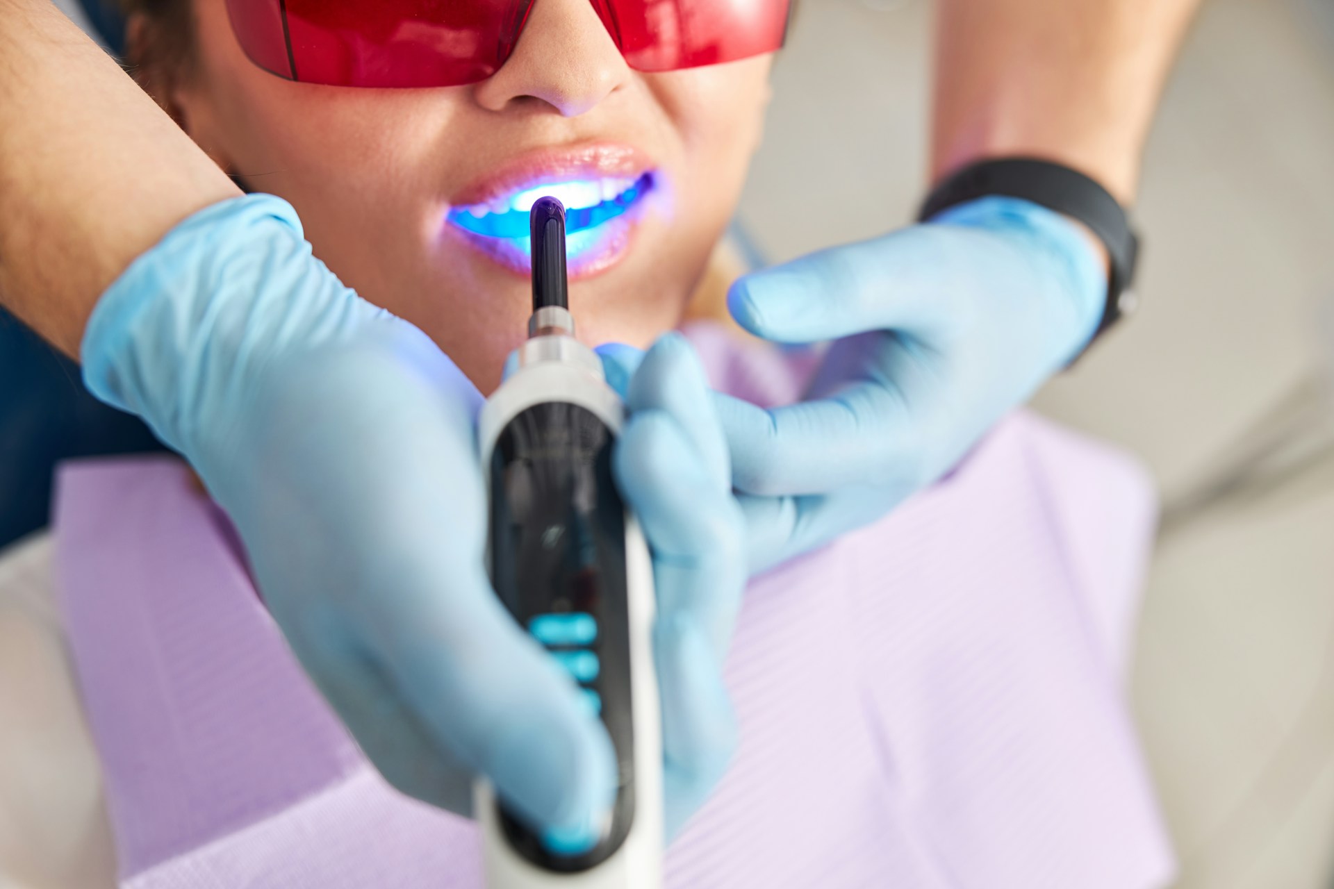 Best Time for a Teeth Whitening Touch-Up