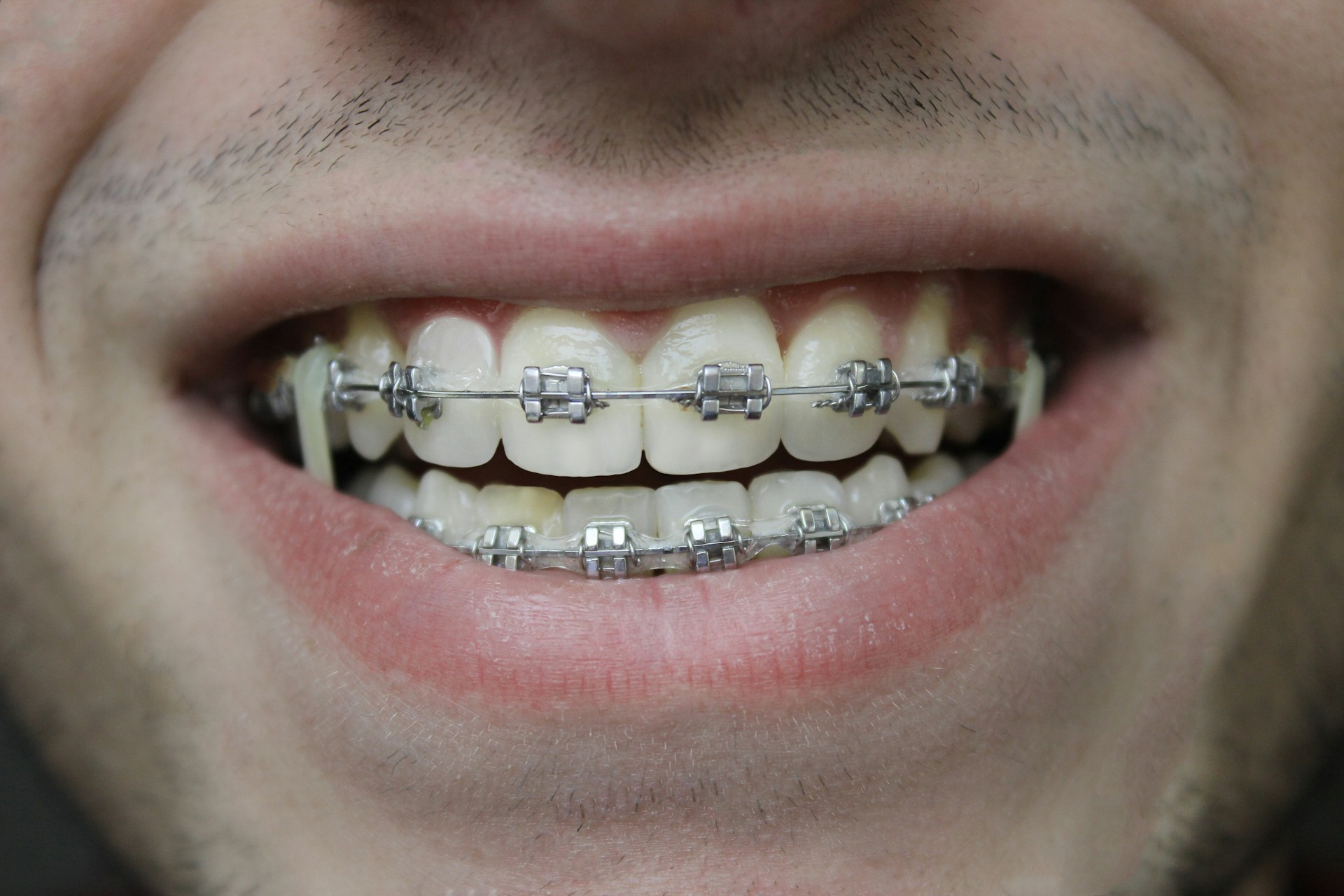 Dental Care Near Whiteland, IN