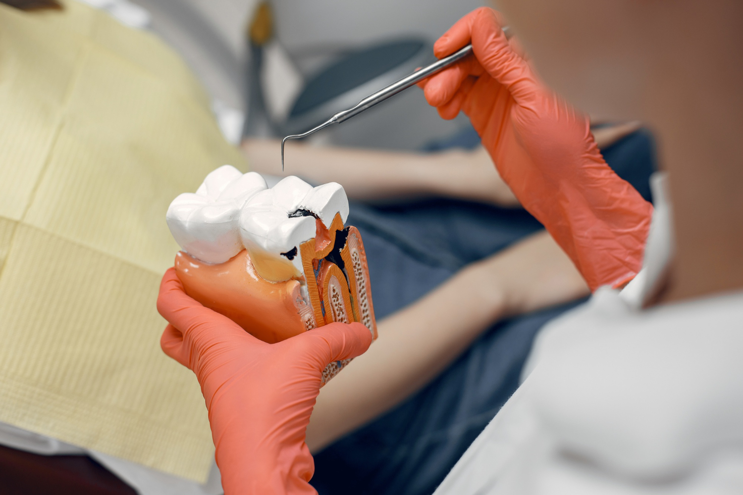 Is a Root Canal Better Than Tooth Removal?
