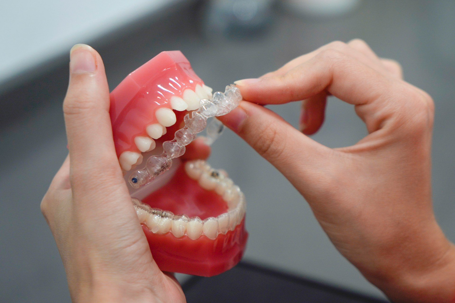 Can Invisalign Fix Small Gaps in Teeth?