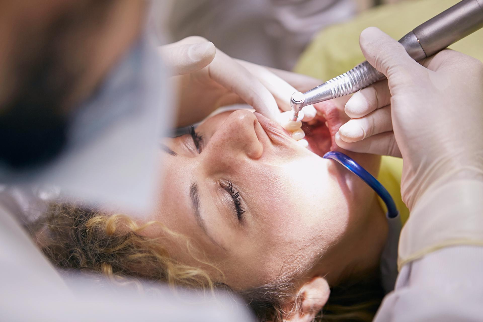 How to Prepare for Your Next Dental Cleaning