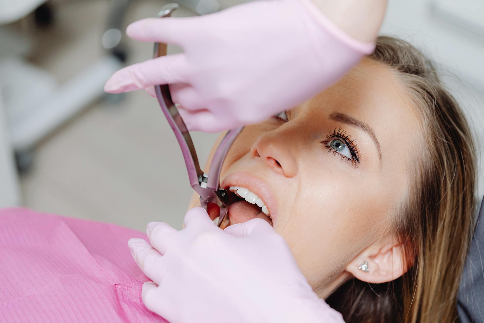 When Is Tooth Extraction in Greenwood the Best Option