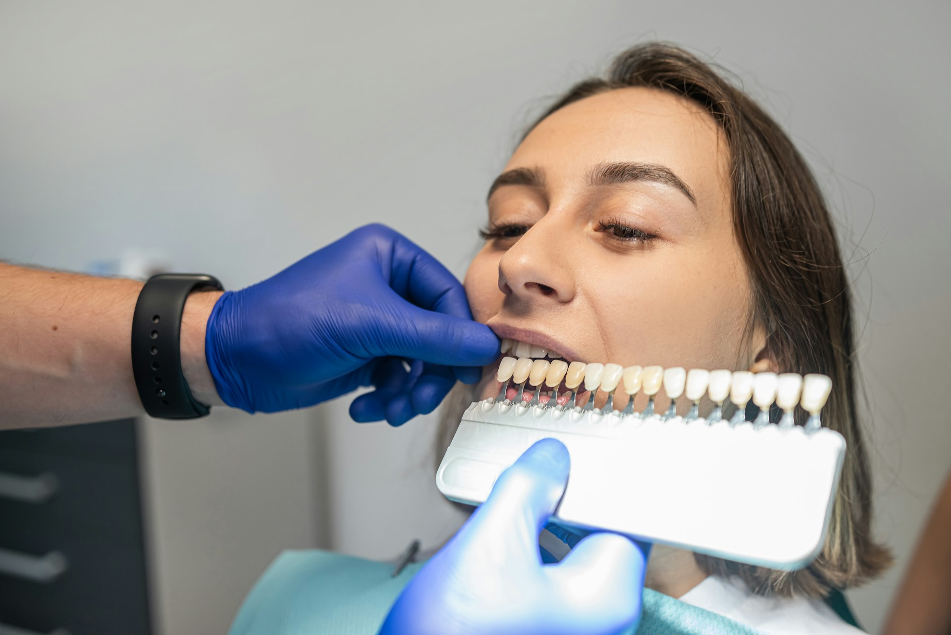 Are Dental Veneers Right for You? What Adults Should Know