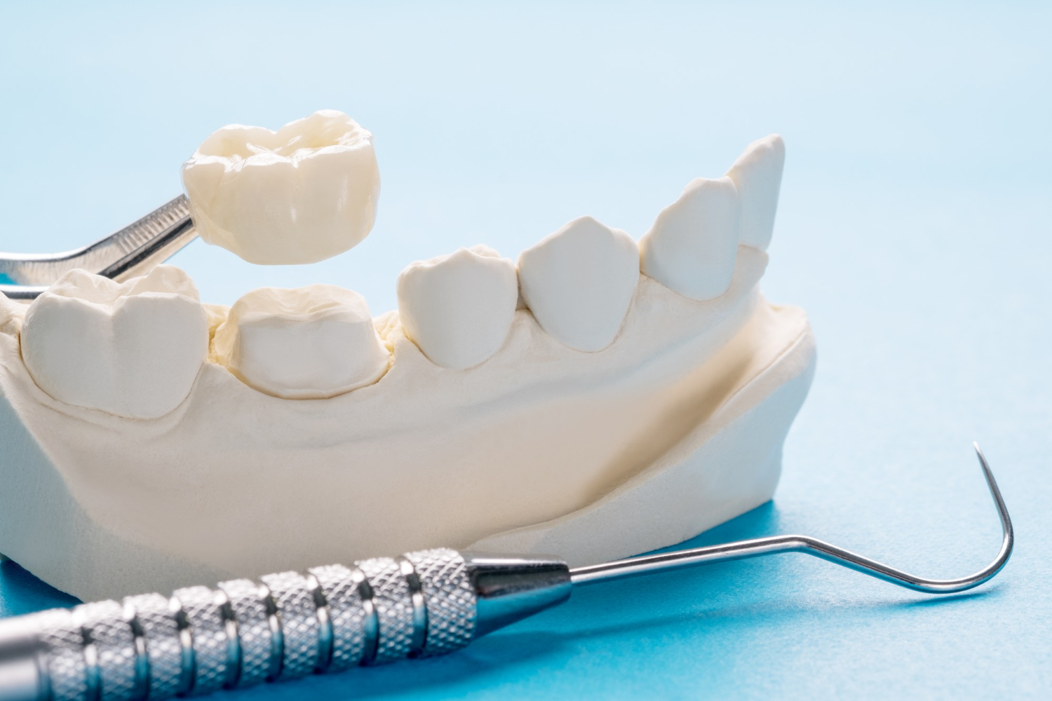 How Modern Dental Crowns Are Designed to Look and Feel Natural