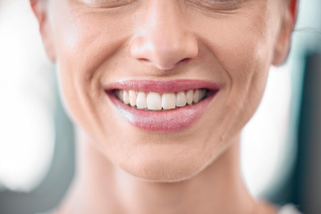 discolored teeth