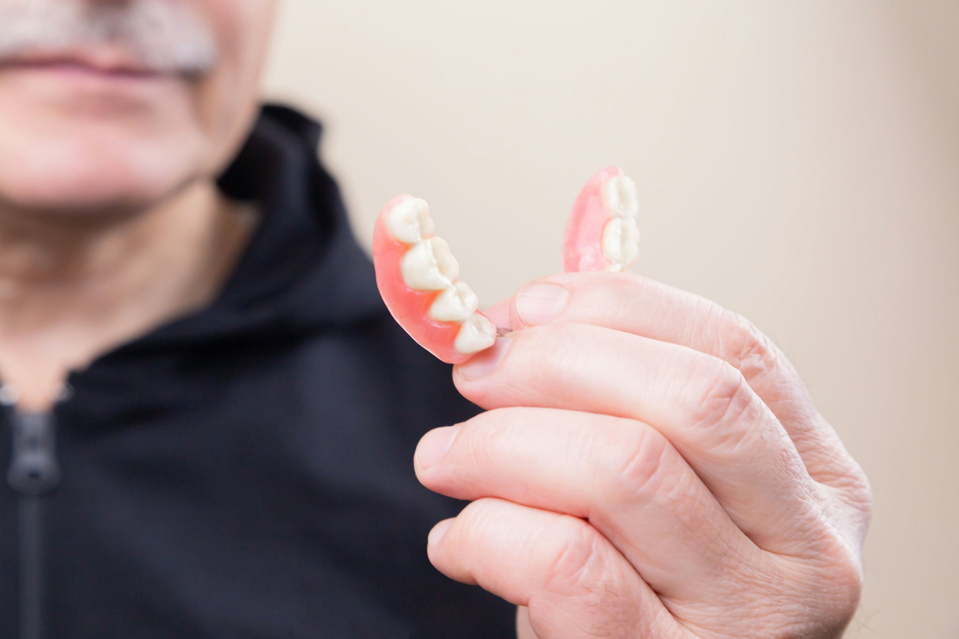 Dental Implants vs. Dentures: Stability, Comfort, and Longevity