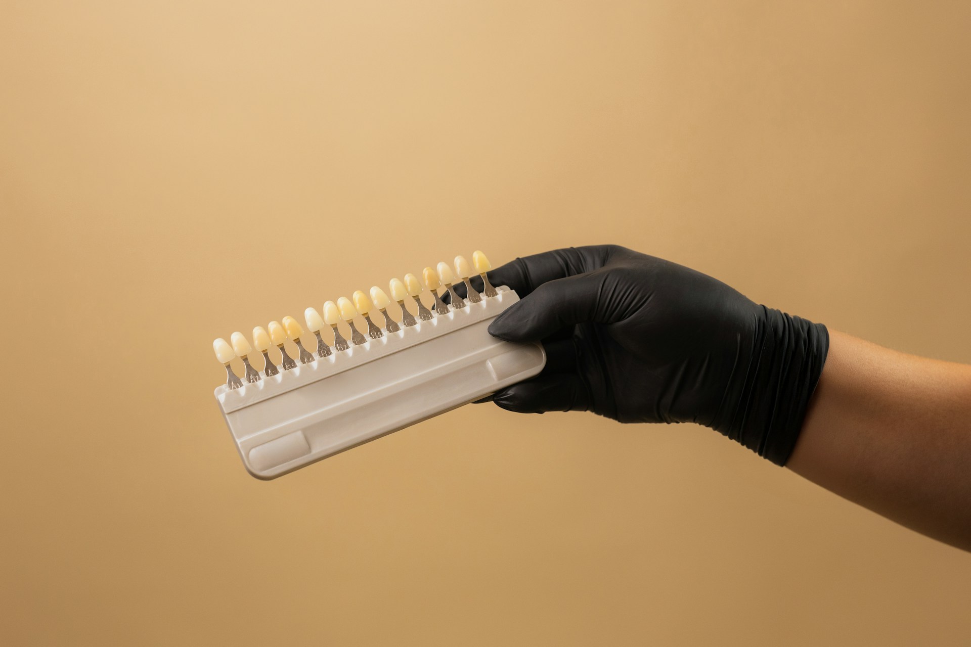 Choosing Between Veneers and All-on-4 for a Confident Smile