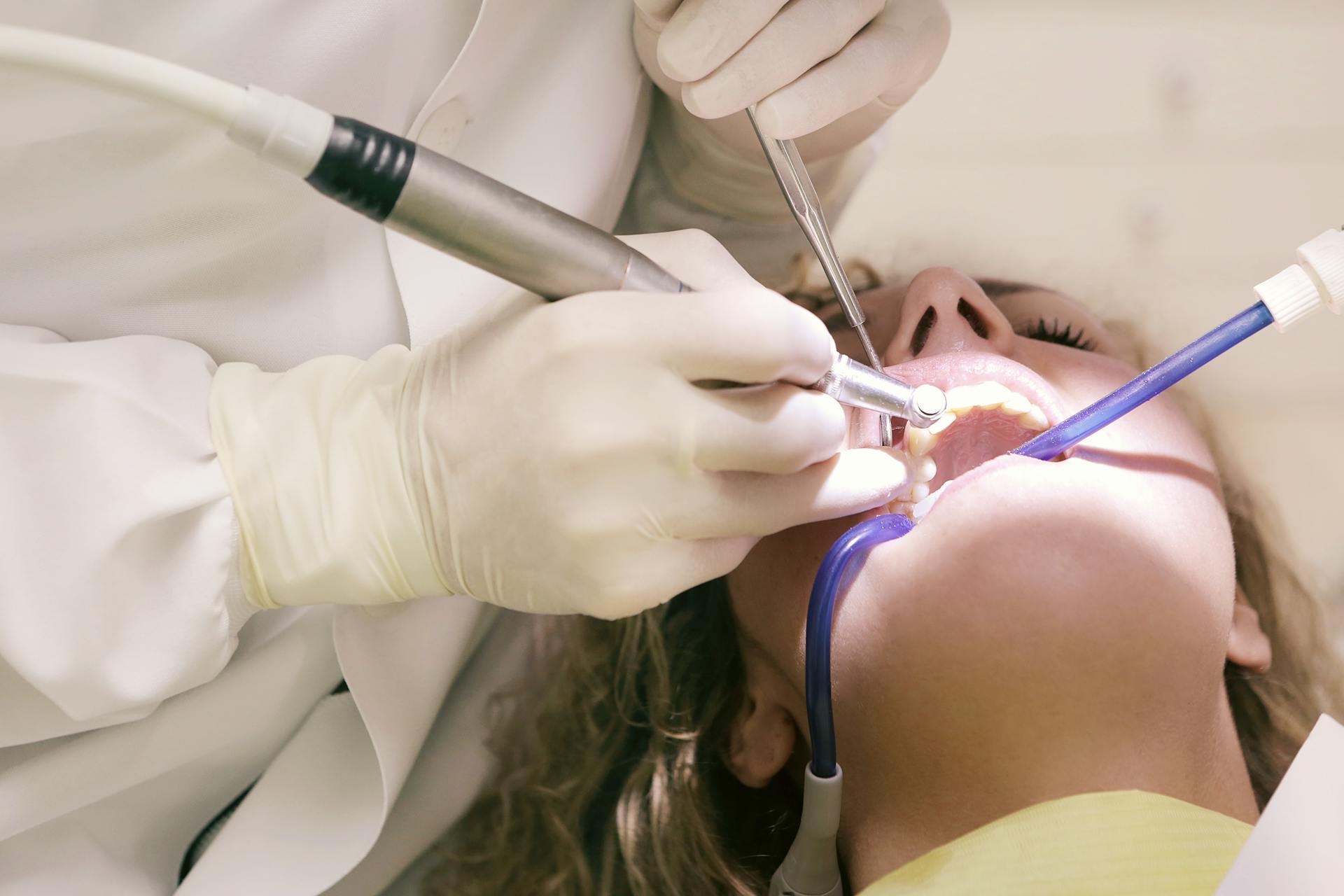 What Full-Mouth Rehabilitation Means and Who It Helps